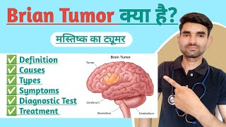 Brain tumor ct [upl. by Asenav972]