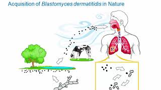 Dimorphic Fungi Blastomycosis Hot Topic [upl. by Lozano]