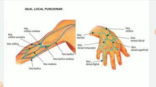 Qual a melhor veia para puncionar [upl. by Darrick]