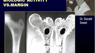 Radiographic Approach to Bone Lesions Part I [upl. by Darsie243]