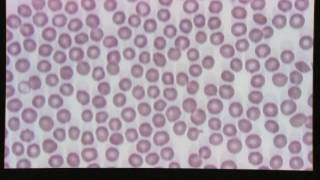 Blood Smear Evaluation [upl. by Whiteley952]