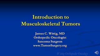 Orthopedic Oncology Course  Malignant Bone Forming Tumors Osteosarcoma  Lecture 4 [upl. by Jewelle]