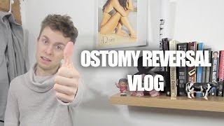 My Stoma Reversal Surgery  Ostomy Vlog [upl. by Boigie]