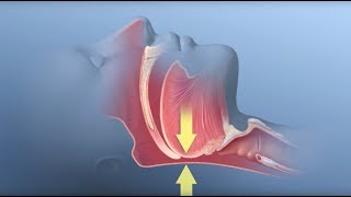 Unable to sleep at night  Sleeping Difficulty Treatment  DrManaswini Mullapudi  Doctors Circle [upl. by Renfred]