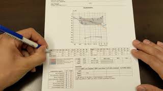 How to Read Your Hearing Test [upl. by Milas687]