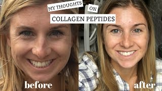 My Thoughts on Collagen Peptides  Benefits  Plus My Before and After [upl. by Latsirc]